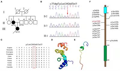 Novel Frameshift Heterozygous Mutation in UBAP1 Gene Causing Spastic Paraplegia-80: Case Report With Literature Review